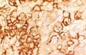 エボラウイルス実験感染サルの肝臓