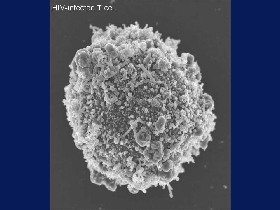 HIV-EM
